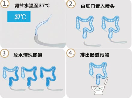 大(dà)腸水(shuǐ)療過程
