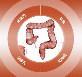 結腸炎危害