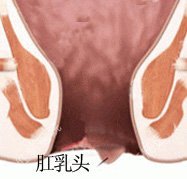 肛乳頭liu